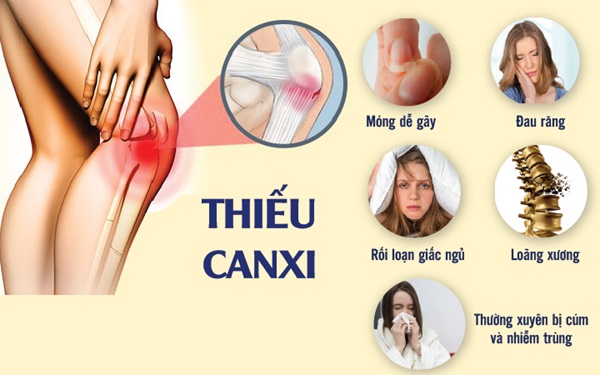 10+ Triệu chứng thiếu canxi thường gặp dễ nhận biết