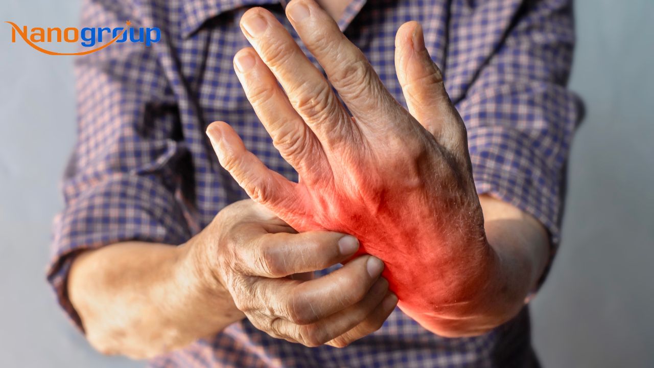 Viêm khớp dạng thấp: Nên chọn loại sữa nào phù hợp với từng cơ địa?